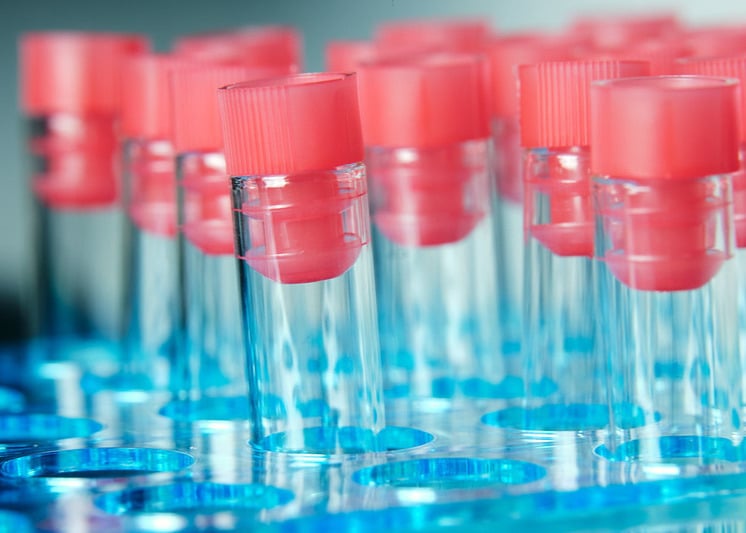 COVID Diagnostics_Medical test tubes